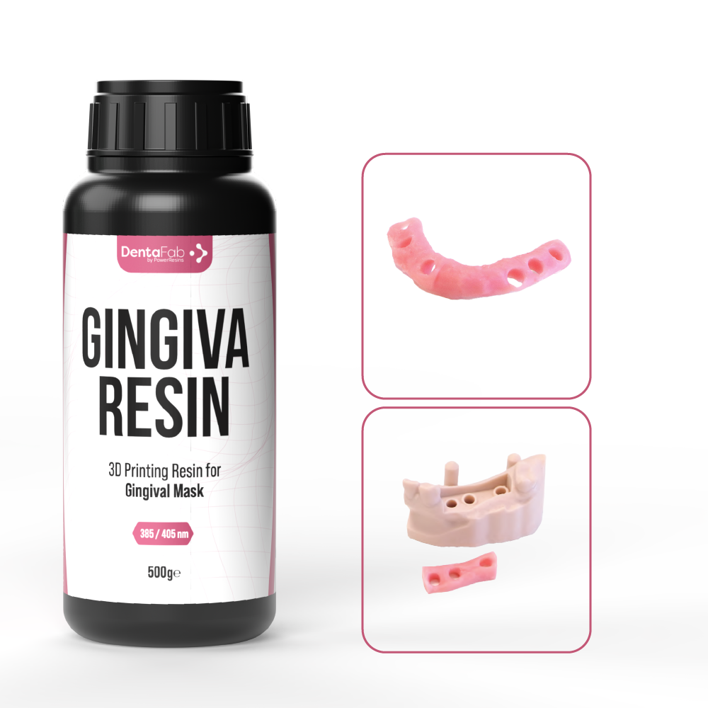 GINGIVA